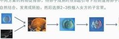 胰岛素抵抗去深圳做三代试管麻烦吗？需要花费多少钱？